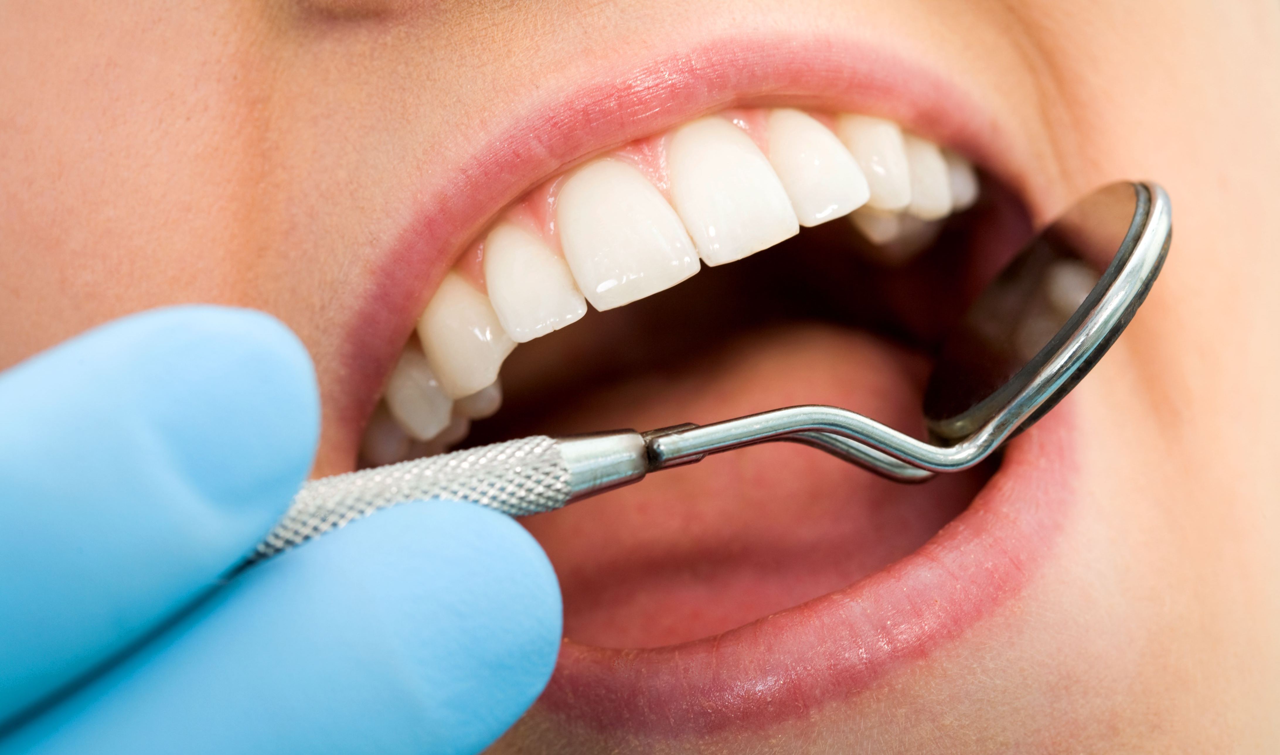 Можно вылечить зубы разом. Терапевтическая стоматология. Профессиональная гигиена полости. Профессиональная гигиена полости рта.