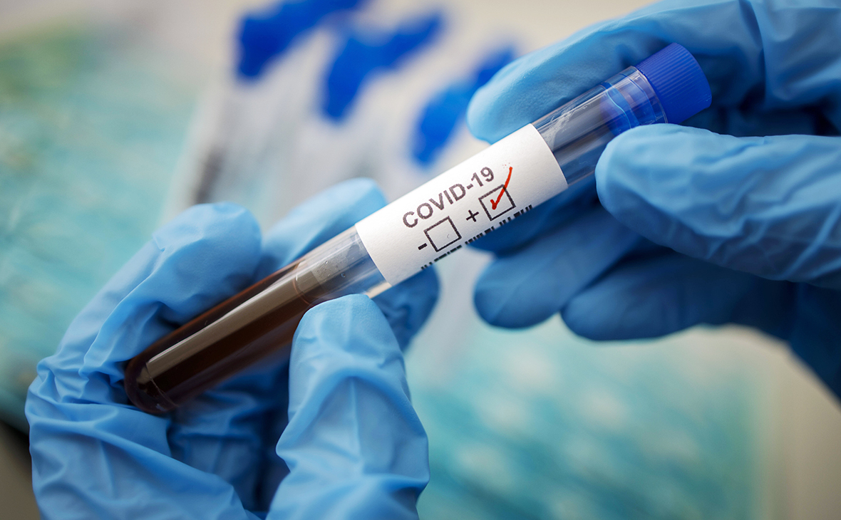Директор лаборатории «Олимп» объяснил дороговизну тестов на коронавирус