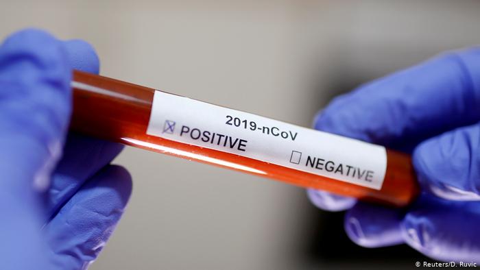 Минздрав РК: дефицита тестов на коронавирус в стране нет