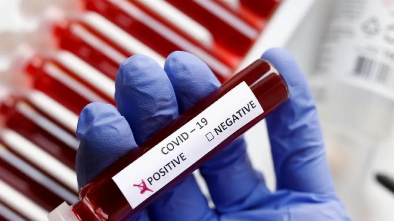 Резкий всплеск случаев заражения коронавирусом зафиксирован в Казахстане