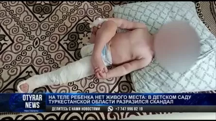 Машина наехала на полуторагодовалого ребенка в детском саду Туркестанской области