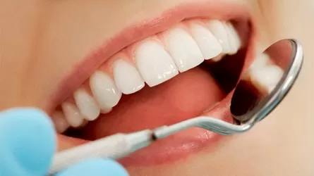 Кто в Казахстане может рассчитывать на бесплатного стоматолога?