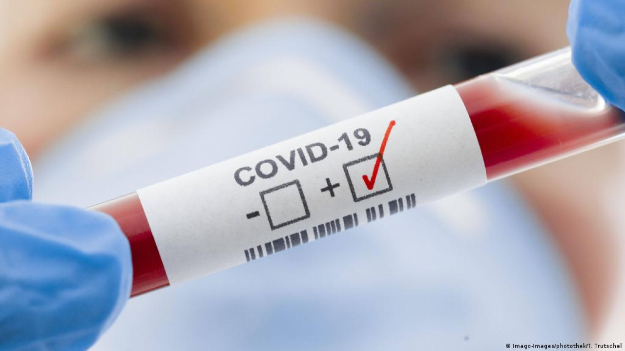 Число заболеваний COVID-19 в Европе за полтора месяца увеличилось втрое - ВОЗ
