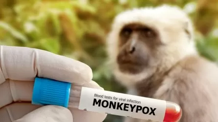 Ученые назвали новые симптомы оспы обезьян