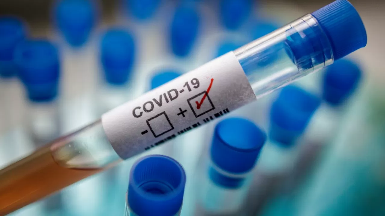  2021 человек заразился коронавирусом за сутки в Казахстане