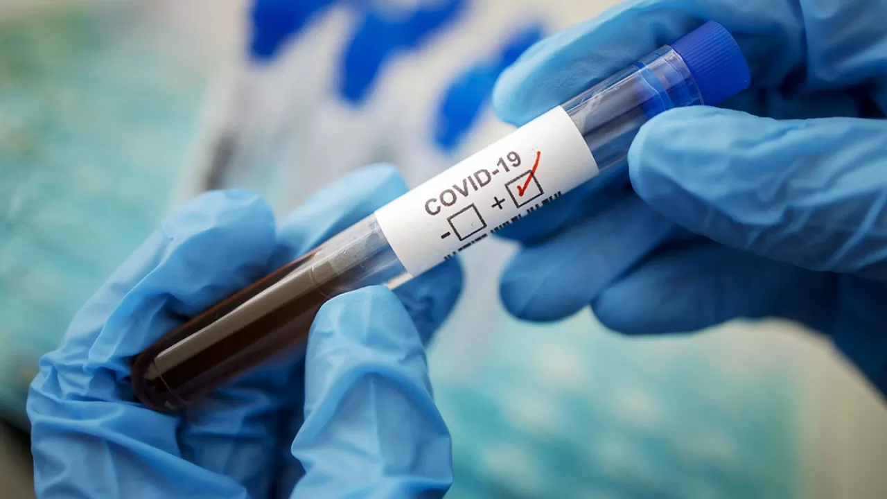 76 новых случаев коронавируса выявили в Казахстане