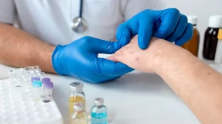 В Атырауской области вспышка кори произошла из-за отказа от вакцинации 