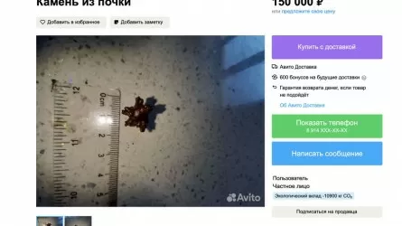 Камень из почки за 150 тыс. рублей продает россиянин