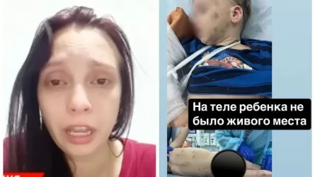 «Денесінің сау тамтығы жоқ»: Солтүстік Қазақстанда 4 жасар науқас баласын алып қашқан әйел табылып, ауруханаға жатқызылды