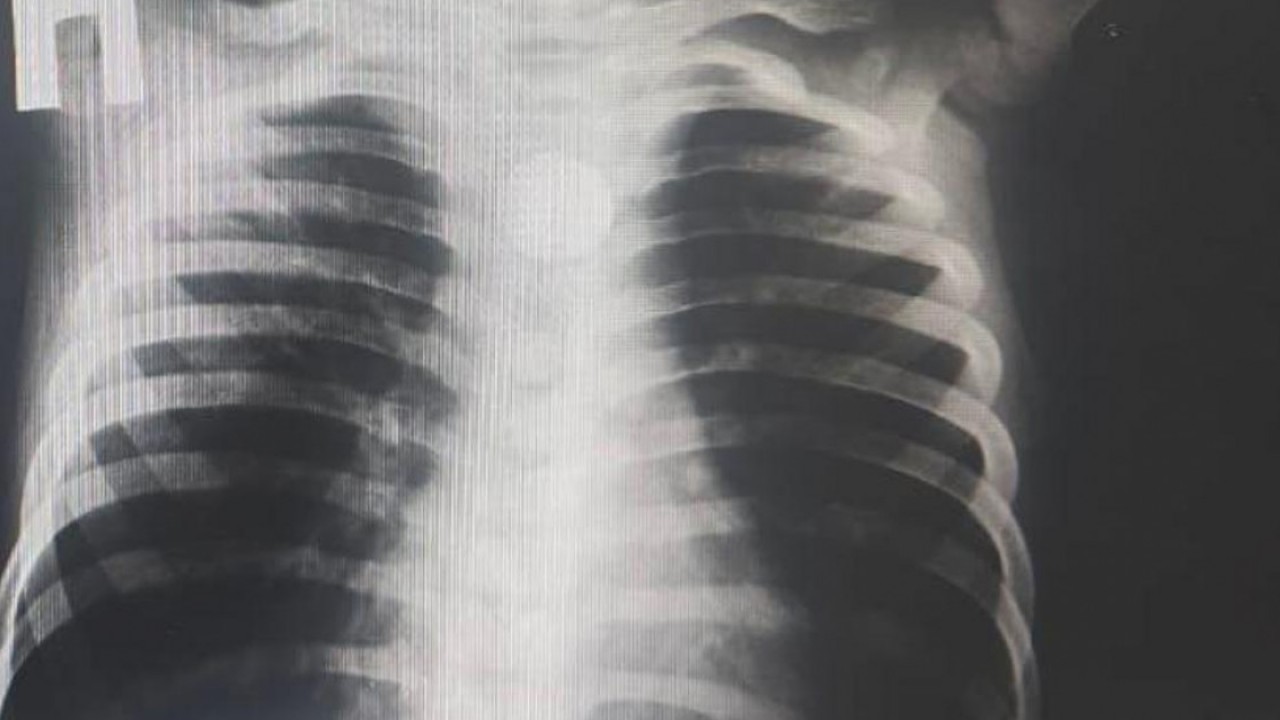 pezhnya.ru сайтындағы секс суреттері