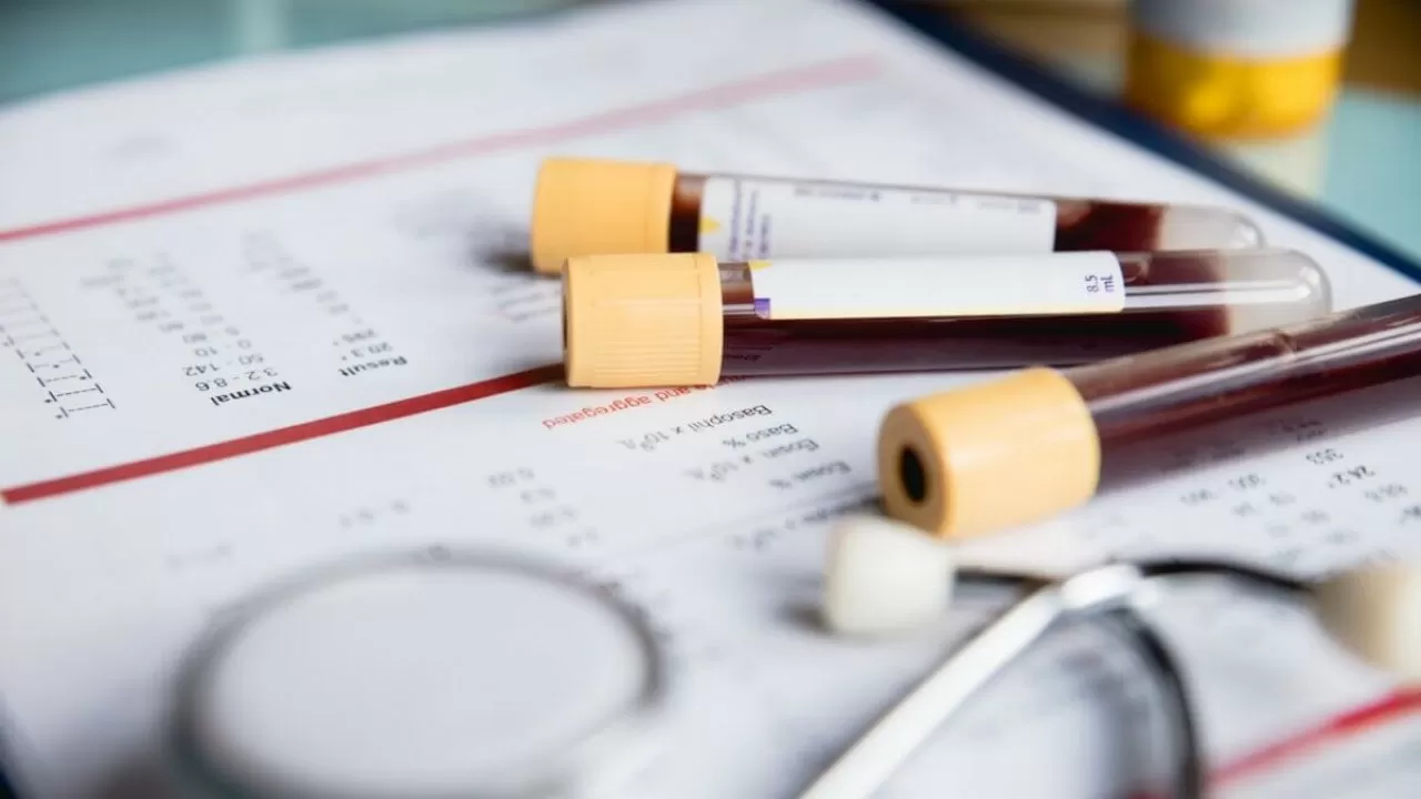 Елімізде скрининг жүйесі жаңарды