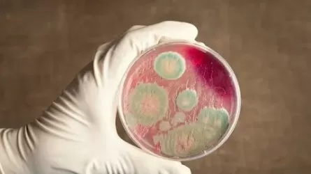 Угрожает ли сибирская язва жителям Алматинской области