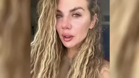 Певица Анна Седокова сообщила, что к ней вернулась cтрашная болезнь 