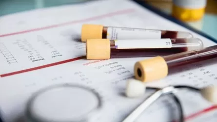 Елімізде скрининг жүйесі жаңарды