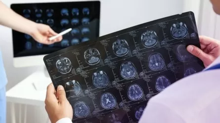 Ғалымдар адамның жасөспірім кезеңі 32 жасқа дейін жалғасатынын анықтады