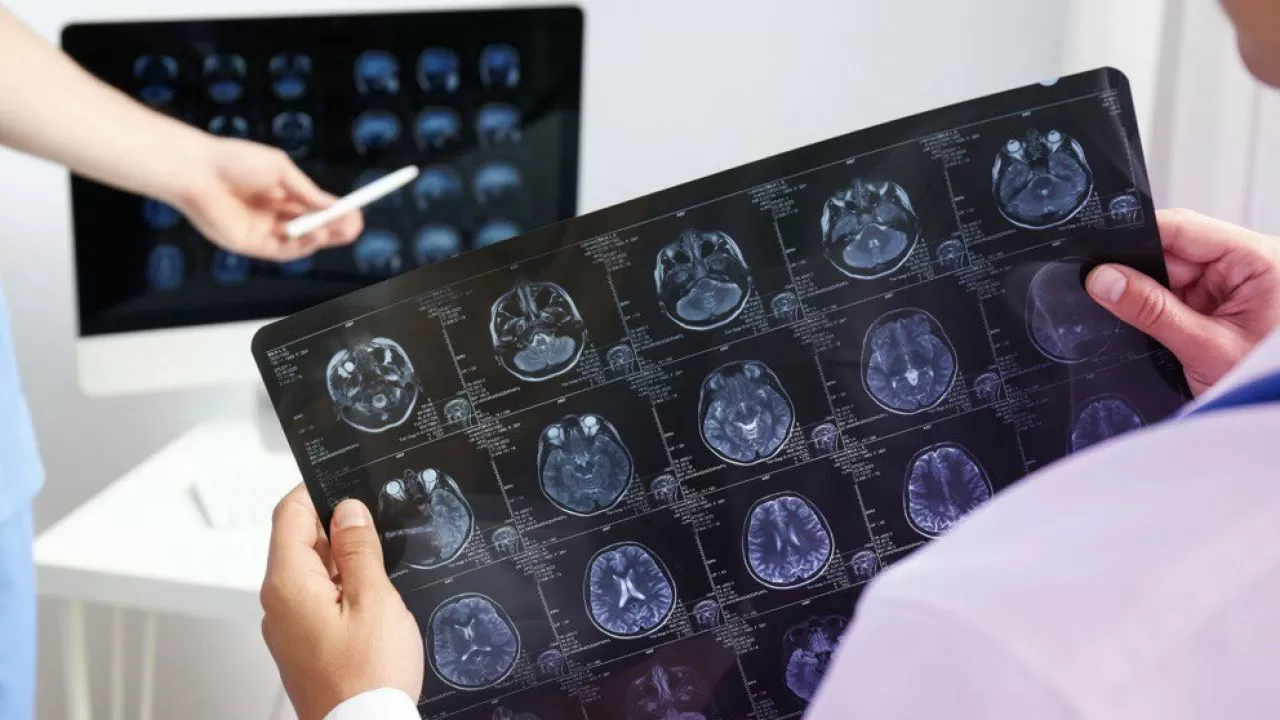 Ғалымдар адамның жасөспірім кезеңі 32 жасқа дейін жалғасатынын анықтады