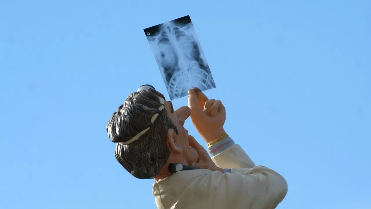 Как будет проходить в РК скрининг рака легкого: подробности 