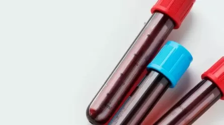 Жыл басынан бері Астанада 130 адам АИТВ жұқтырды