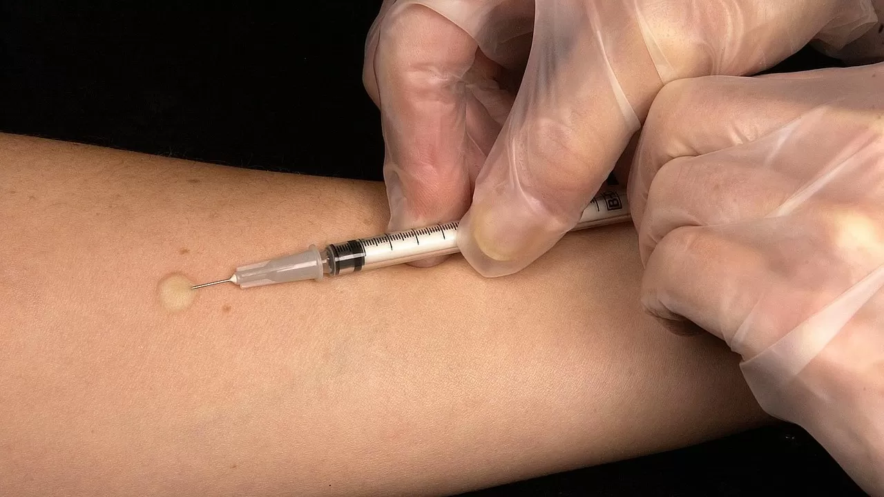 Цели устойчивого развития по туберкулезу достигнуты в РК  