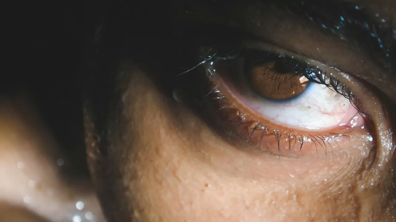 Распространенное нарушение зрения может скрывать ранний признак рака