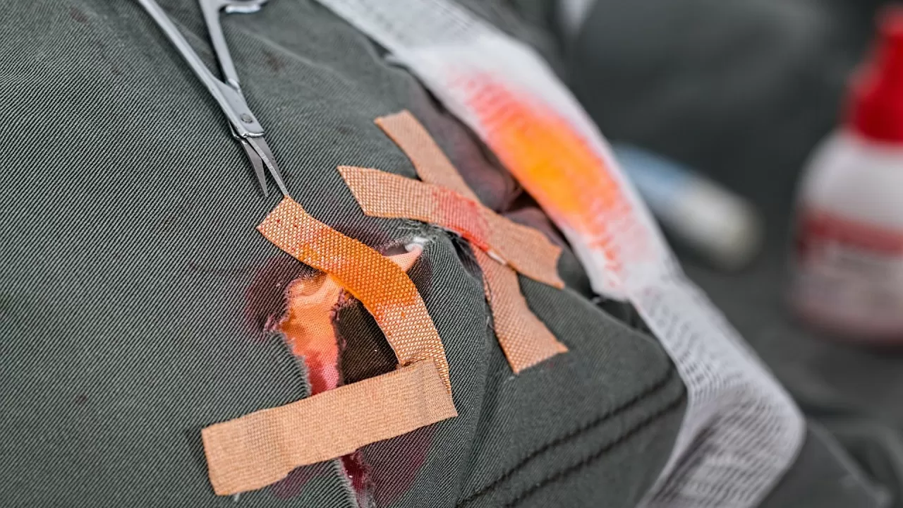 Более 3 млн казахстанцев получили помощь травматологов в 2025 году 