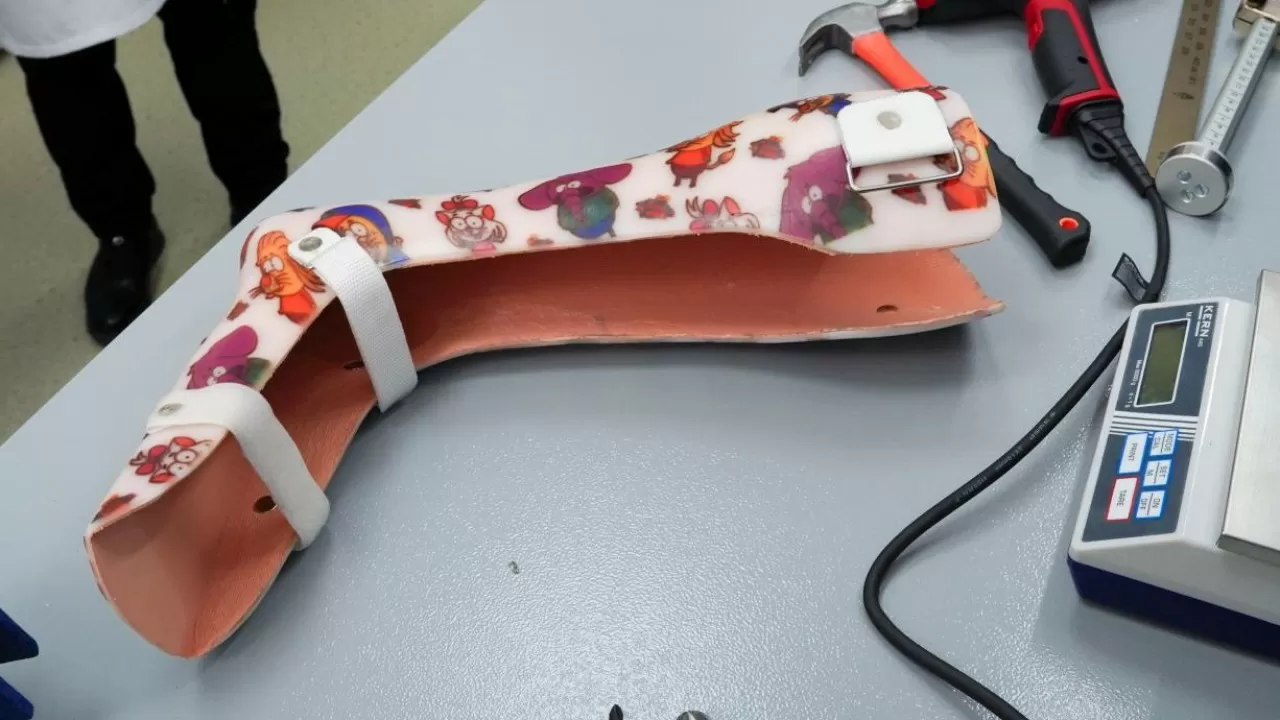 Бесплатно и по 3D-технологиям: в Алматы начали производить уникальные ортезы 