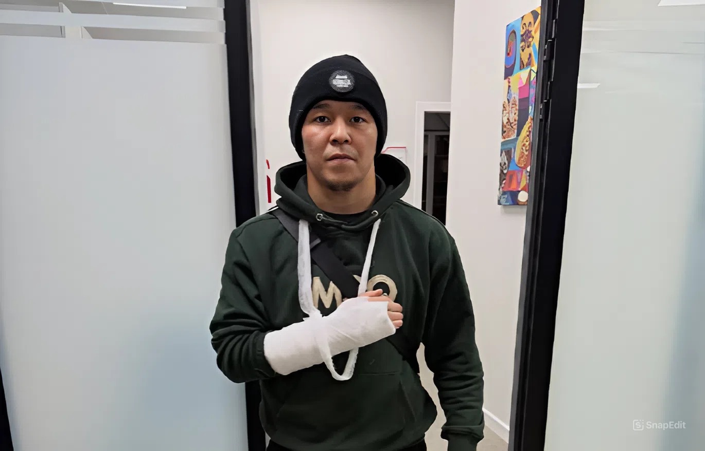 Асу Алмабаев жекпе-жек алдында жарақат алып қалды