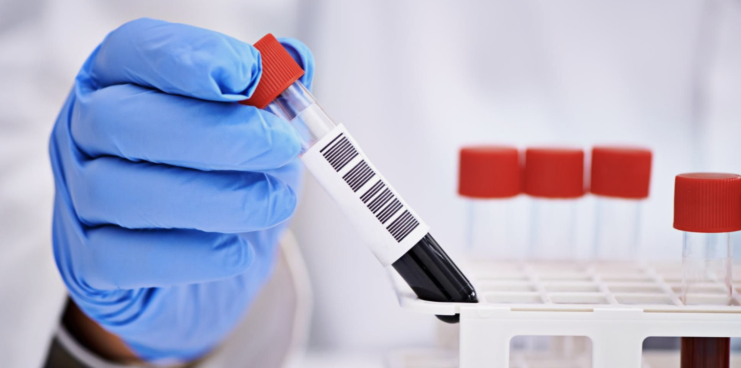 Денсаулық сақтау министрлігі қызылшаның өршуіне байланысты мәлімдеме жасады