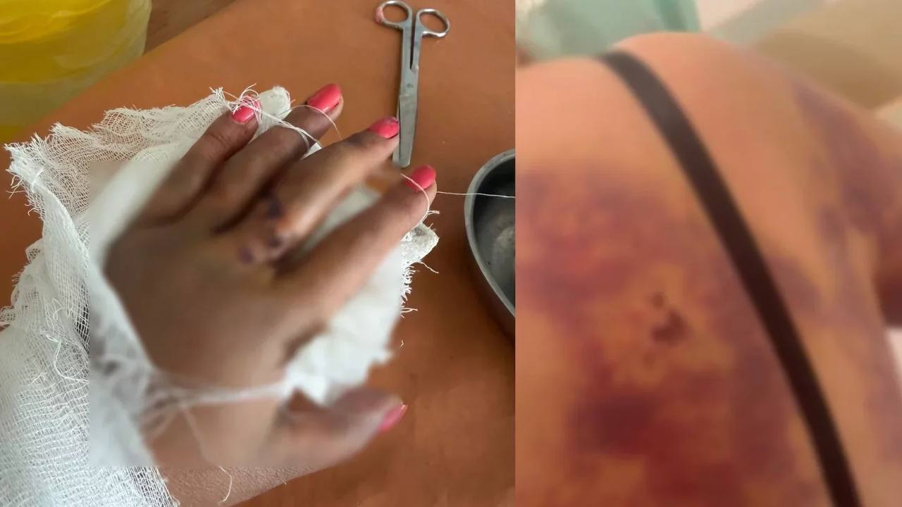 Жетісу облысында мас ер адам көрші әйелді күрекпен аяусыз ұрған