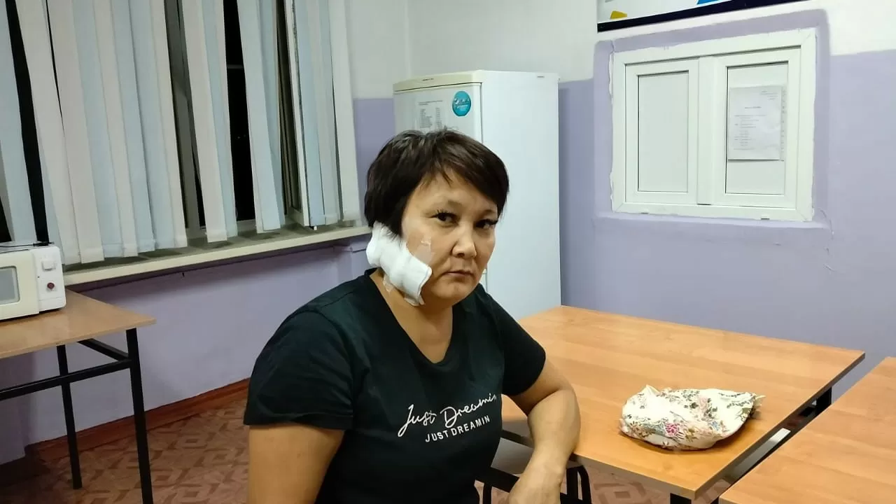 Отрезал ухо бывшей жене: женщина рассказала о жестоком нападении в ВКО