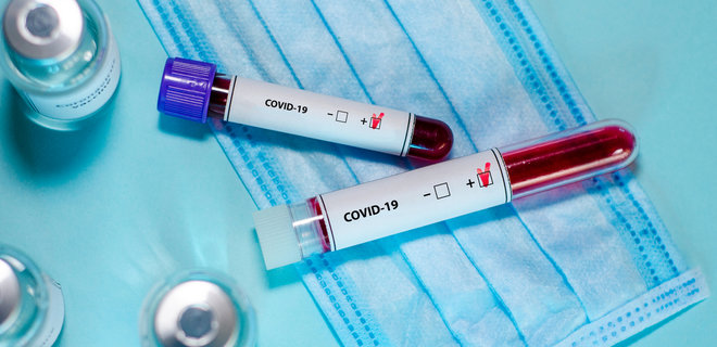У 124 человек подтвердили диагноз "коронавирус"     
