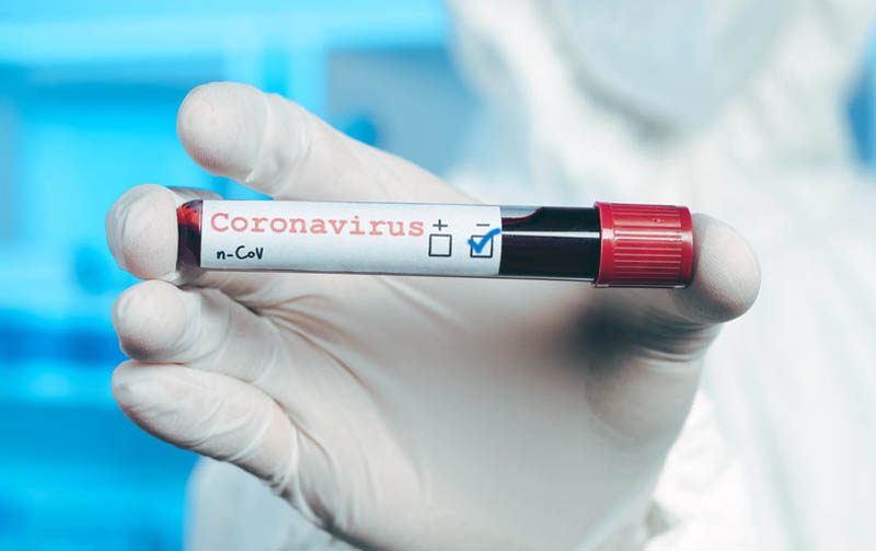 Қарағанды облысында 7 адам коронавирус індетінен емделіп шықты