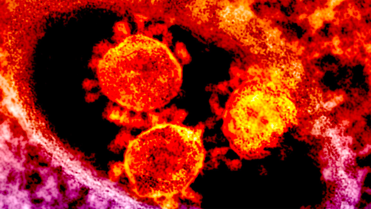 Инкубационный период при заражении новым коронавирусом может достигать 27 дней
