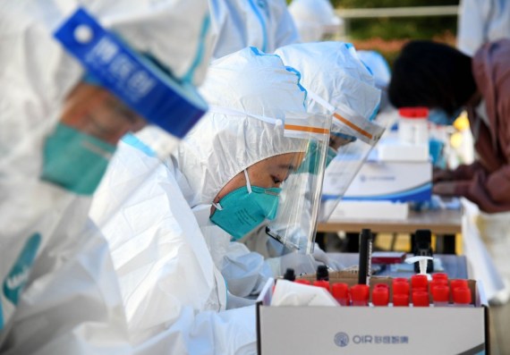 В Китае впервые обнаружили живой штамм коронавируса нового типа на упаковках замороженной продукции