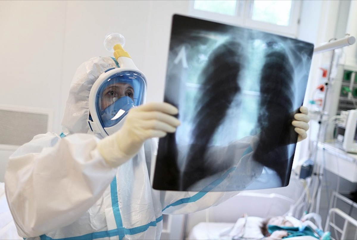За неделю в Казахстане от пневмонии умерли 120 человек