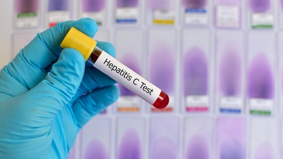Медики выступают за активизацию скрининга для прояснения ситуации с гепатитом в Казахстане