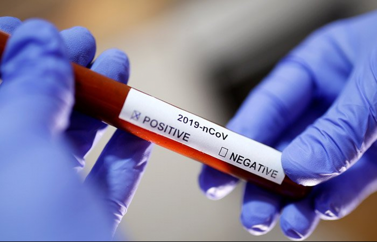 Зарегистрированы еще 22 случая заражения коронавирусной инфекцией