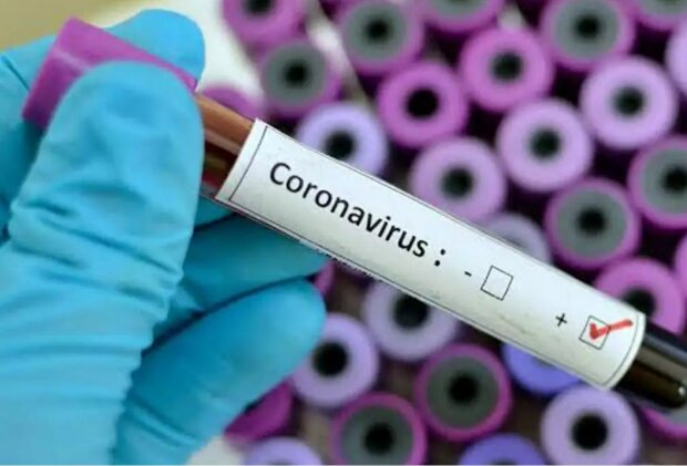 Тағы 5 қазақстандықтан коронавирус анықталды