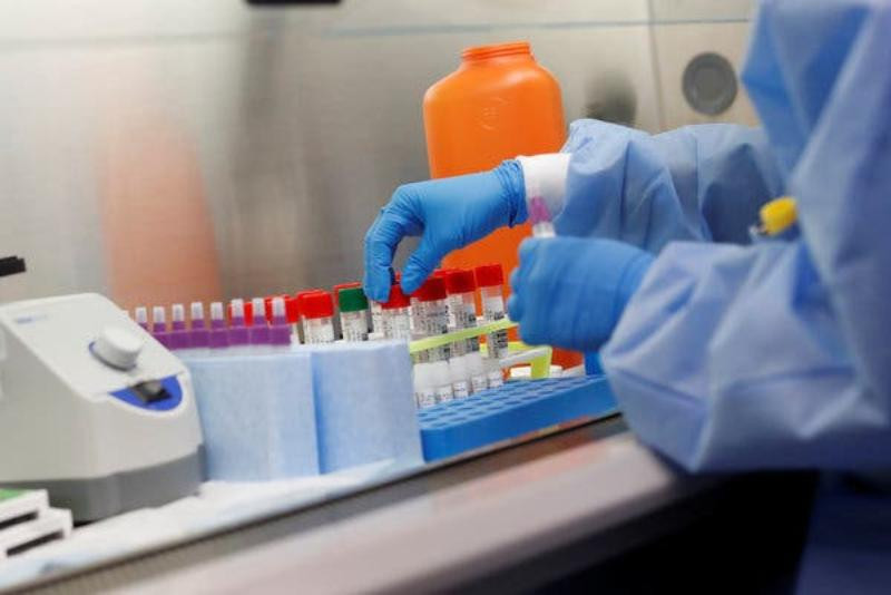 В Акмолинской области у 56 человек подтвердили диагноз "коронавирус"     
