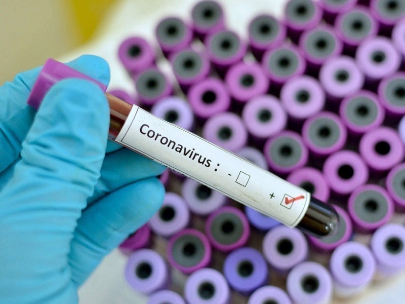 Шұғыл штабтан тағы 18 адамның коронавирус жұқтырғаны хабарланды