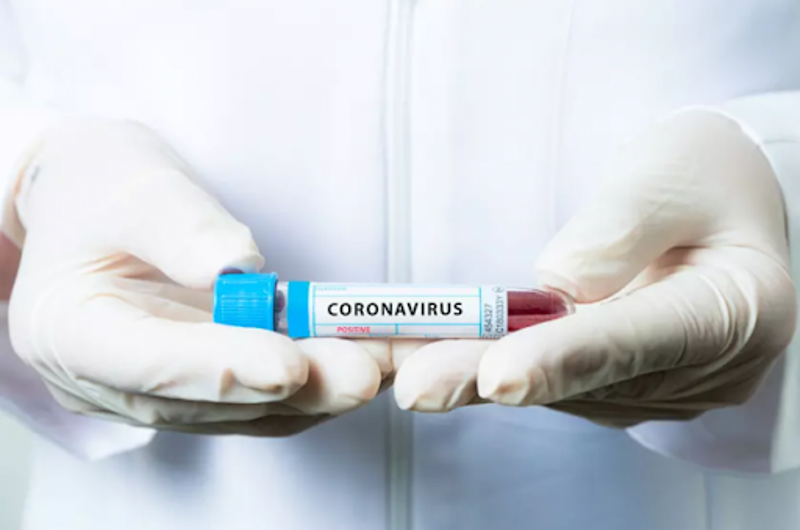 Названо число казахстанцев, заразившихся коронавирусом 