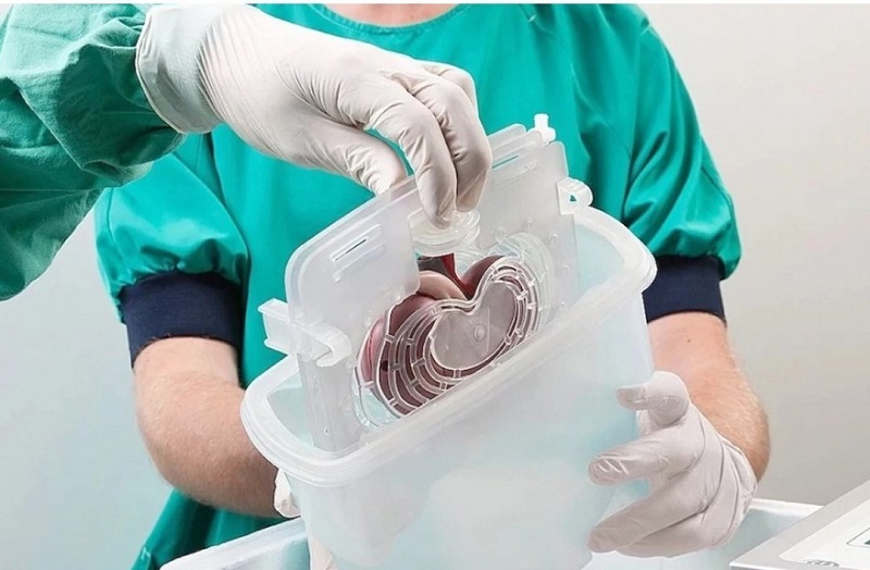 "Реестр несогласных" на посмертную трансплантацию органов планируют создать в Казахстане  