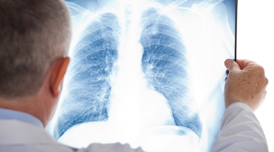 Пневмония жаз кезіне тән емес – ресейлік пульмонолог 