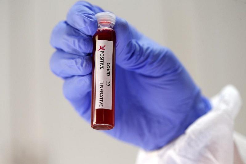 Количество новых случаев коронавируса приближается к 4000 в РК   