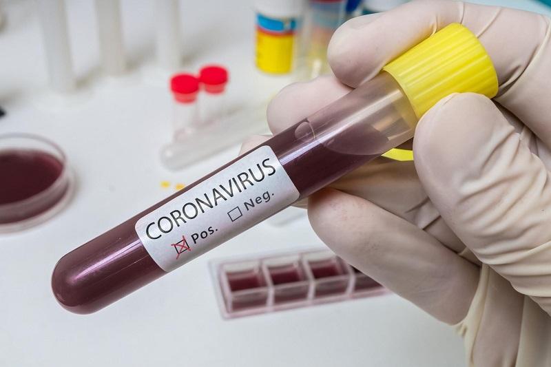 Еще пять случаев заражения коронавирусом выявлены в Казахстане  