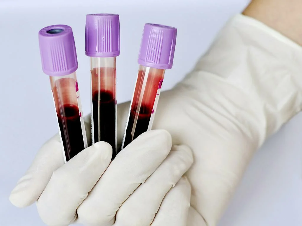Какая связь может быть между группой крови и опасными заболеваниями  