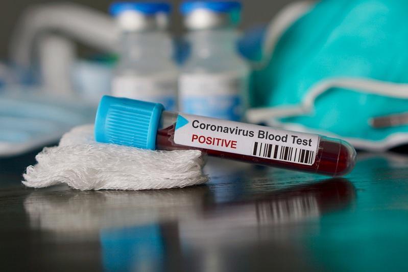 Количество новых случаев коронавируса в РК перевалило за  2400 