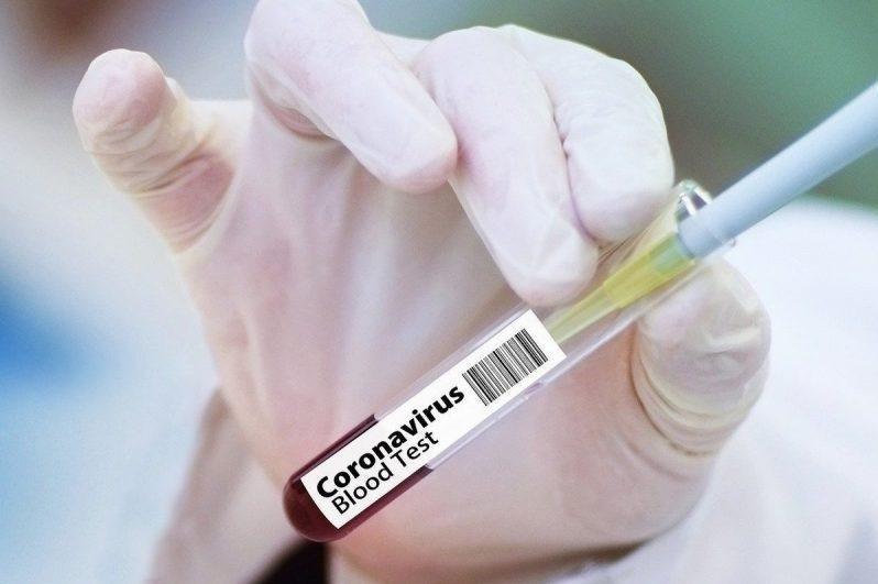 Өткен тәулікте 2122 адам коронавирус инфекциясын жұқтырды  