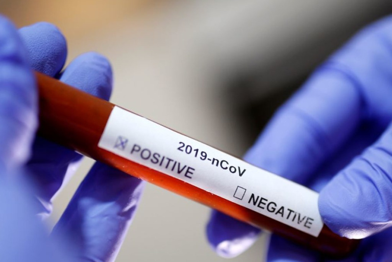 Қырғызстанда коронавирус жұқтырған 3 адам анықталды