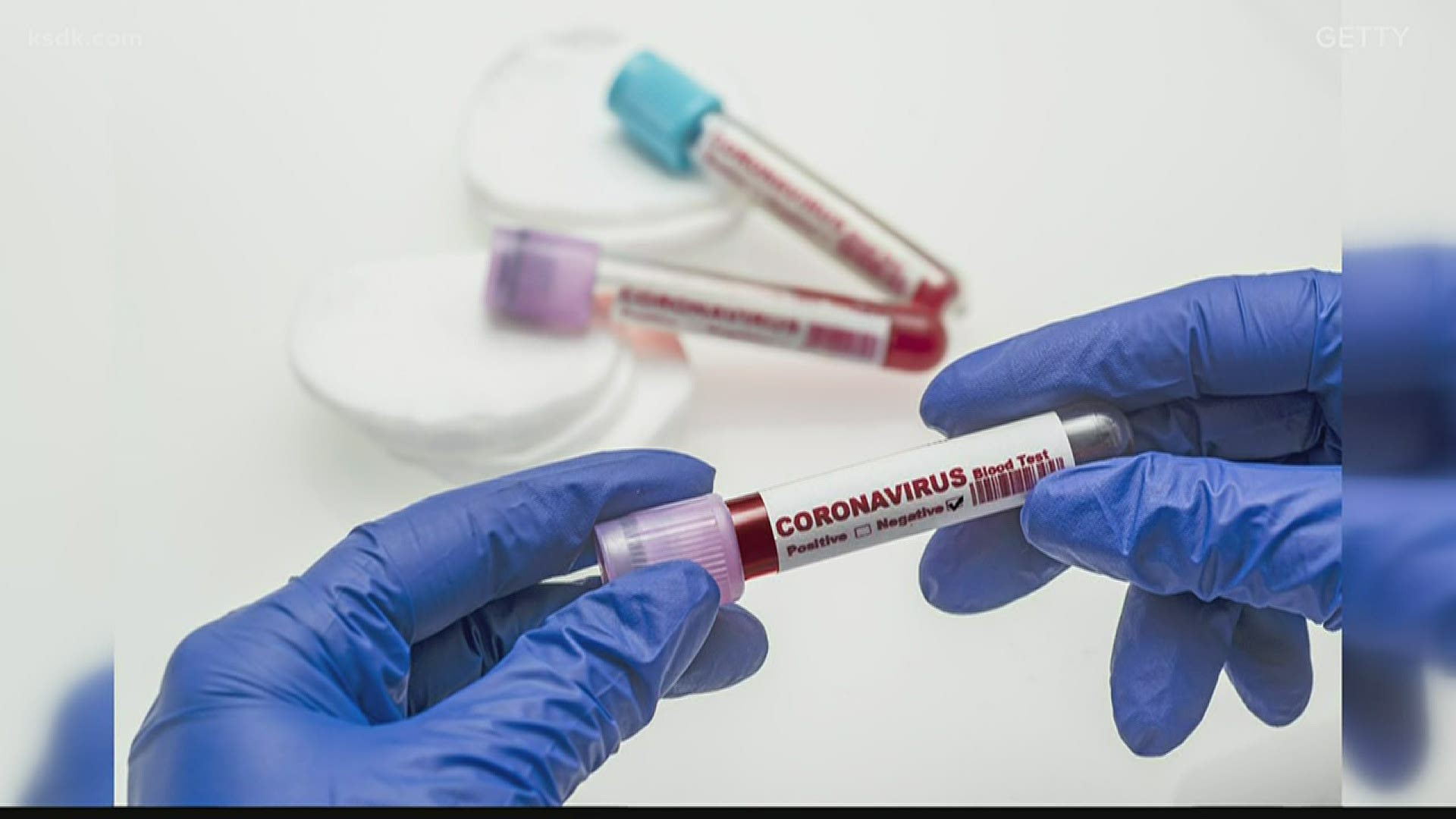 В России выявили максимум новых случаев заражения коронавирусом 